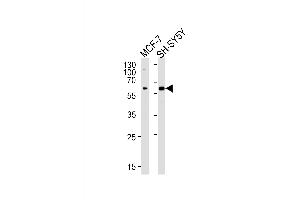 anti-Zinc Finger and BTB Domain Containing 22 (ZBTB22) (AA 476-502), (C-Term) antibody