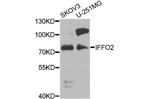 Western blot analysis of extracts of various cell lines, using IFFO2 antibody (ABIN2563343) at 1:1000 dilution. (IFFO2 anticorps)