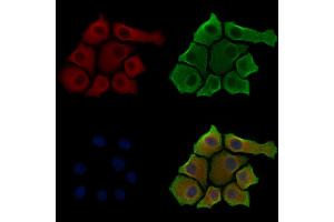 Phospho-RAB7L1 (Thr71) Antibody staining HepG2 cells(serum starvation treatment) by IF/ICC. (RAB7L1 anticorps  (pThr71))