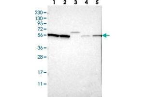 Western blot analysis of Lane 1: RT-4, Lane 2: U-251 MG, Lane 3: Human Plasma, Lane 4: Liver, Lane 5: Tonsil with SLC15A4 polyclonal antibody  at 1:250-1:500 dilution. (SLC15A4 anticorps)