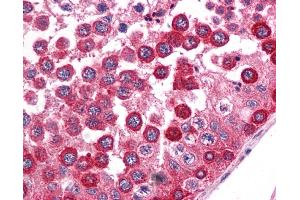 Immunohistochemistry (IHC) image for anti-Wingless-Type MMTV Integration Site Family, Member 2B (WNT2B) (N-Term) antibody (ABIN2776722)