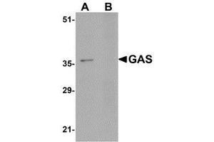Western blot analysis of GAS in EL4 cell lysate in (A) the absence and (B) the presence of blocking peptide with AP30357PU-N GAS antibody at 1μg/ml.