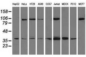 Image no. 2 for anti-X-Ray Repair Complementing Defective Repair in Chinese Hamster Cells 1 (XRCC1) antibody (ABIN1501770) (XRCC1 anticorps)