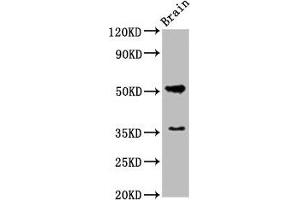 Western Blot Positive WB detected in: Rat brain tissue All lanes: Chrm1 antibody at 5. (CHRM1 anticorps  (AA 210-366))