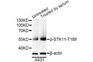 Western blot analysis of extracts of A431 cells, using Phospho-STK11-T189 antibody (ABIN5995630) at 1/1000 dilution. (LKB1 anticorps  (pThr189))