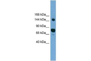 WB Suggested Anti-AGTPBP1 Antibody Titration: 0. (AGTPBP1 anticorps  (N-Term))