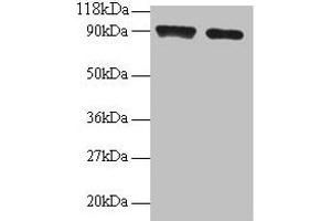 Western blot All lanes: SAT1 antibody at 2 μg/mL Lane 1: 293T whole cell lysate Lane 2: EC109 whole cell lysate Secondary Goat polyclonal to rabbit IgG at 1/15000 dilution Predicted band size: 21 kDa Observed band size: 90 kDa
