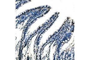 IHC analysis of splicing factor 1 using anti-splicing factor 1 antibody (ABIN7600193). (Splicing Factor 1 anticorps  (AA 160-266))