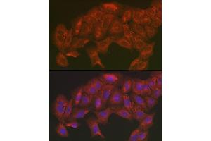 Immunofluorescence analysis of U2OS cells using [KO Validated] SOD2 Rabbit pAb (ABIN3021903, ABIN3021904, ABIN3021905 and ABIN6217382) at dilution of 1:200 (40x lens).