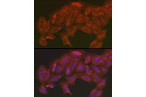 Immunofluorescence analysis of U2OS cells using [KO Validated] SOD2 Rabbit pAb (ABIN3021903, ABIN3021904, ABIN3021905 and ABIN6217382) at dilution of 1:200 (40x lens). (SOD2 anticorps  (AA 25-222))