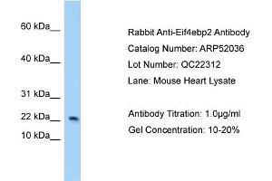 Western Blotting (WB) image for anti-Eukaryotic Translation Initiation Factor 4E Binding Protein 2 (EIF4EBP2) (N-Term) antibody (ABIN2784743) (eIF4EBP2 anticorps  (N-Term))