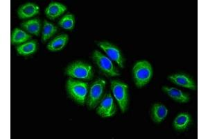 Immunofluorescent analysis of A549 cells using ABIN7153847 at a dilution of 1:100 and Alexa Fluor 488-congugated AffiniPure Goat Anti-Mouse IgG(H+L).