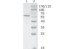 Western-Blot analysis of HIV-1 HAN subtype gag protein using HIV-1 p24 (05-001) antibody. (HIV-1 p24 anticorps  (AA 48-62))