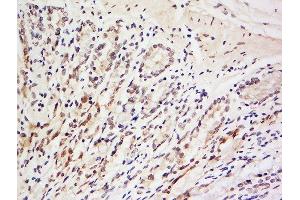 Formalin-fixed and paraffin embedded rat brain labeled with Anti-LRRC39 Polyclonal Antibody, Unconjugated  at 1:200 followed by conjugation to the secondary antibody and DAB staining.