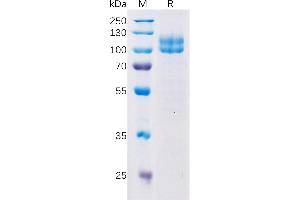 Human SL Protein, hFc Tag on SDS-PAGE under reducing condition.