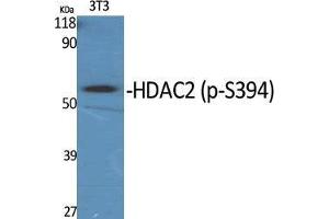 Western Blot (WB) analysis of specific cells using Phospho-HDAC2 (S394) Polyclonal Antibody.