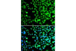 Immunofluorescence analysis of A-549 cells using BCAS3 antibody.
