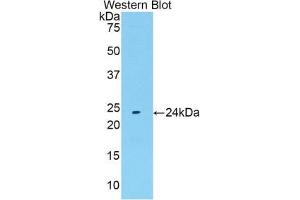 Western blot analysis of the recombinant protein. (FGF13 anticorps  (AA 1-192))