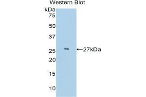 Detection of Recombinant PDCN, Mouse using Polyclonal Antibody to Podocin (PDCN) (Podocin anticorps  (AA 138-371))