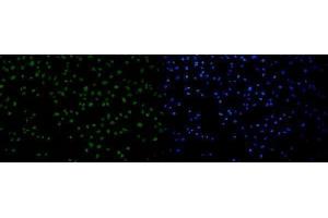 IF analysis of 53BP1/TP53BP1 using anti-53BP1/TP53BP1 antibody (ABIN7599869). (TP53BP1 anticorps  (AA 1239-1972))