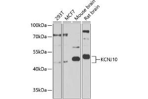Western blot analysis of extracts of various cell lines, using KCNJ10 Antibody (ABIN6134092, ABIN6142719, ABIN6142720 and ABIN6225135) at 1:1000 dilution.