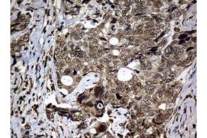 Image no. 3 for anti-Nibrin (NBN) (AA 461-754) antibody (ABIN1491539)