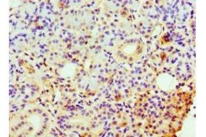 Immunohistochemistry of paraffin-embedded human pancreatic tissue using ABIN7147891 at dilution of 1:100 (CLDN14 anticorps  (AA 140-239))
