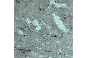 IHC on rat brain using Rabbit antibody to VPS45A  at a concentration of 10 µg/ml.