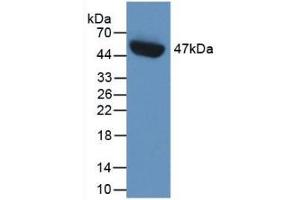 Detection of Recombinant PAI1, Human using Monoclonal Antibody to Plasminogen Activator Inhibitor 1 (PAI1)