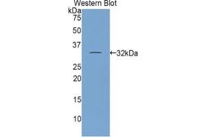 Detection of Recombinant ITIH1, Mouse using Polyclonal Antibody to Inter Alpha-Globulin Inhibitor H1 (ITIH1) (ITIH1 anticorps  (AA 413-660))