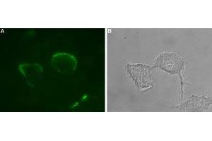 Expression of P2X1 receptor in rat PC12 cells - Cell surface detection of P2X1 receptor in intact living PC12 cells. (P2RX1 anticorps  (Extracellular Loop) (Atto 488))