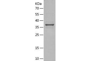 Western Blotting (WB) image for Melan A (MLANA) (AA 1-118) protein (His-IF2DI Tag) (ABIN7123879)