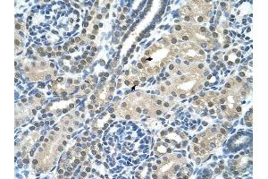 anti-Shwachman-Bodian-Diamond Syndrome (SBDS) (C-Term) antibody