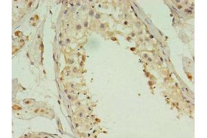 Immunohistochemistry of paraffin-embedded human testis tissue using ABIN7143208 at dilution of 1:100 (ACBD4 anticorps  (AA 1-305))