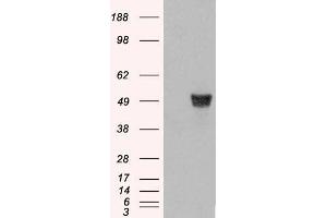 HEK293 overexpressing CORO1A (RC210753) and probed with Antibody (mock transfection in first lane). (Coronin 1a anticorps  (C-Term))