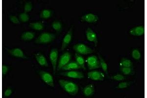 Immunofluorescent analysis of A549 cells using ABIN7176259 at dilution of 1:100 and Alexa Fluor 488-congugated AffiniPure Goat Anti-Rabbit IgG(H+L) (ZNF366 anticorps  (AA 455-650))