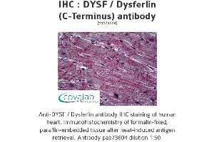 Image no. 1 for anti-Dysferlin (DYSF) (C-Term) antibody (ABIN2852394) (Dysferlin anticorps  (C-Term))