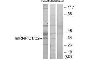 Western Blotting (WB) image for anti-Heterogeneous Nuclear Ribonucleoprotein C (C1/C2) (HNRNPC) (C-Term) antibody (ABIN1849120)