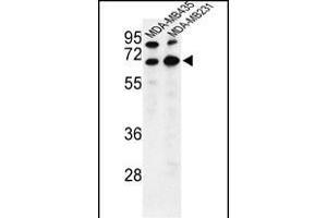 Bestrophin 2 antibody  (C-Term)