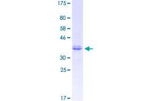 Image no. 1 for Neuropilin 1 (NRP1) (AA 22-131) protein (GST tag) (ABIN2565105)
