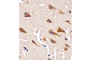 (ABIN6243007 and ABIN6578664) staining Cyclophilin D in human brain tissue sections by Immunohistochemistry (IHC-P - paraformaldehyde-fixed, paraffin-embedded sections).