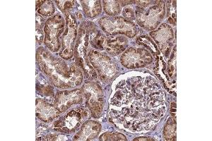 Immunohistochemical staining (Formalin-fixed paraffin-embedded sections) of human kidney shows strong cytoplasmic positivity in renal tubules. (RSPRY1 anticorps)