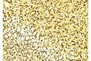 ABIN6276613 at 1/100 staining Human gastric tissue by IHC-P. (NET1 anticorps  (C-Term))