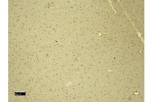 (ABIN184570) (4 μg/mL) staining of paraffin embedded Human Cortex. (DDB1 anticorps  (C-Term))