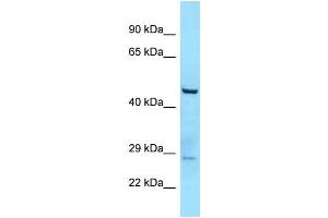 WB Suggested Anti-TTLL3 Antibody Titration: 1. (TTLL3 anticorps  (C-Term))