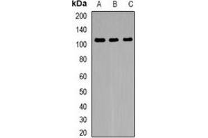 Western blot analysis of FNBP3 expression in HeLa (A), mouse brain (B), rat brain (C) whole cell lysates. (PRPF40A anticorps)