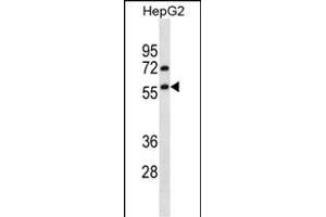 TRIM13 Antibody (N-term) (ABIN657208 and ABIN2850498) western blot analysis in HepG2 cell line lysates (35 μg/lane). (TRIM13 anticorps  (N-Term))