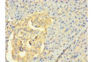Immunohistochemistry of paraffin-embedded human pancreatic tissue using ABIN7158857 at dilution of 1:100 (CDC25C anticorps  (AA 1-473))