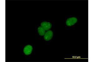 Immunofluorescence of purified MaxPab antibody to C1orf103 on HeLa cell.