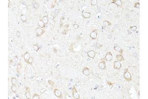 Immunohistochemistry of paraffin-embedded rat brain using MAP1LC3B antibody (ABIN6291775) at dilution of 1:100 (40x lens). (LC3B anticorps)